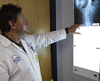 Scoliosis