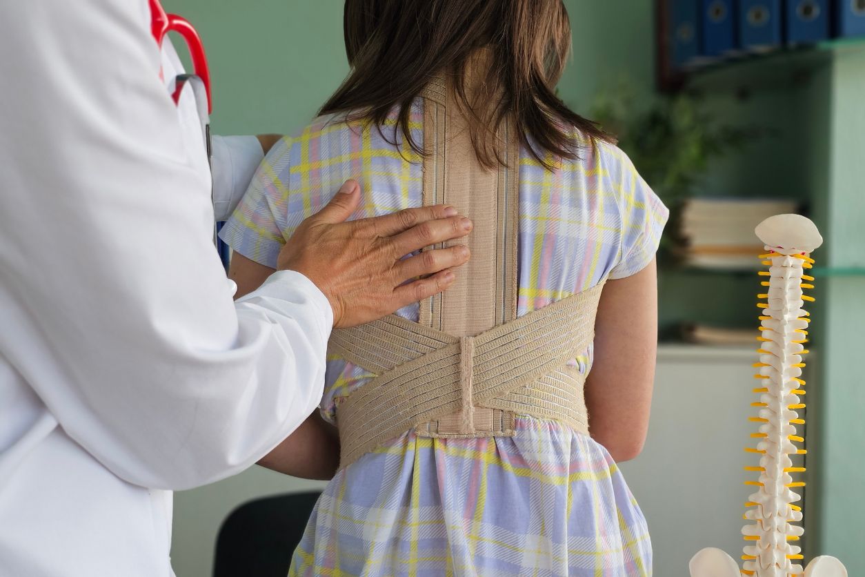 Scoliosis Medical Devices Tools That Help Straighten, Support, and Stabilize the Spine